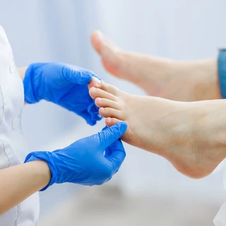 Grzybica stóp – przyczyny, rodzaje, domowe sposoby