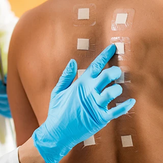 Testy alergiczne skórne